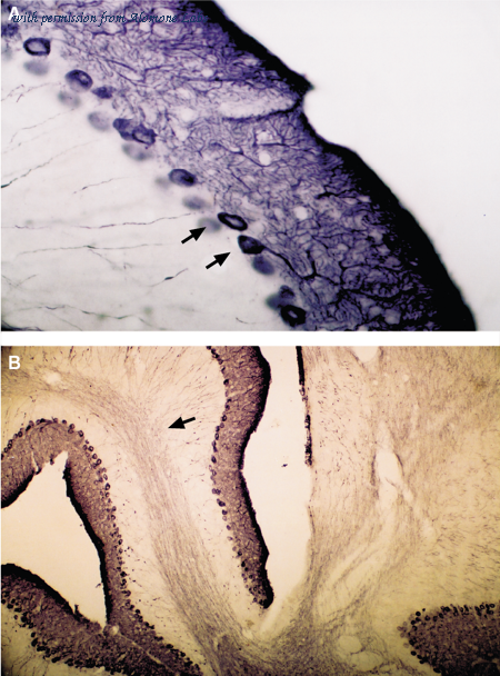 Alomone Labs ACC-019 image 2
