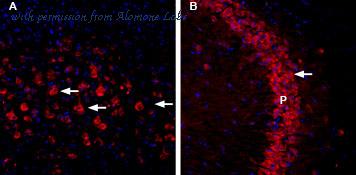 Alomone Labs ACC-041 image 3