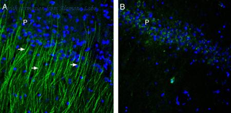Alomone Labs ACC-046 image 2