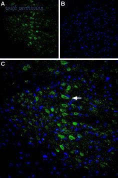 Alomone Labs ACC-112 image 2