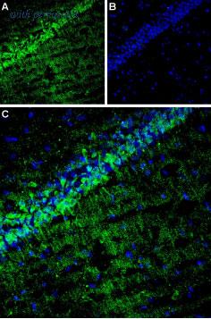 Alomone Labs ACC-125 image 2