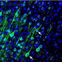 Alomone Labs ACP-004 image 2