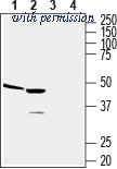 Alomone Labs ACR-022 ͼ 1