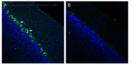 Alomone Labs AAR-014 image 2