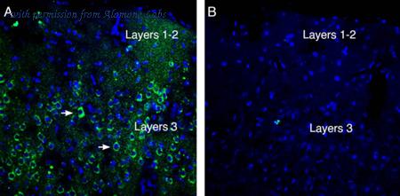 Alomone Labs ANR-195 image 2