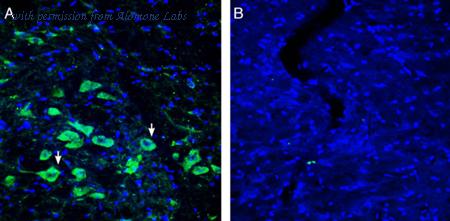 Alomone Labs APR-055 image 2