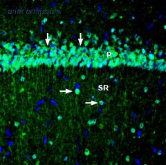 Alomone Labs BLP-PC051 image 1