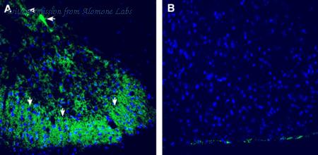 Alomone Labs ACC-142 image 3