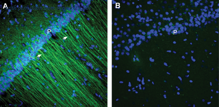 Alomone Labs ACR-072 image 3