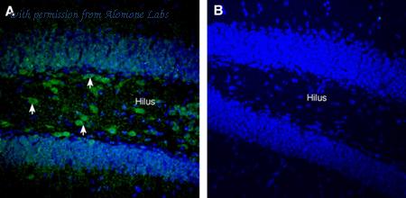 Alomone Labs ANR-126 image 3