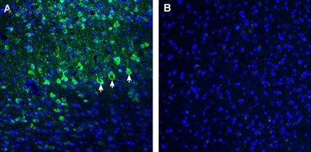 Alomone Labs ANT-047 image 3