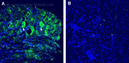 Alomone Labs APC-088 image 3