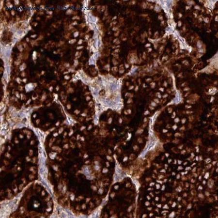 Atlas Antibodies AMAb90523 image 2