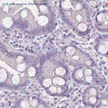 Atlas Antibodies AMAb90523 image 3