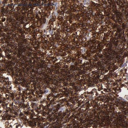 Atlas Antibodies AMAb90535 image 1