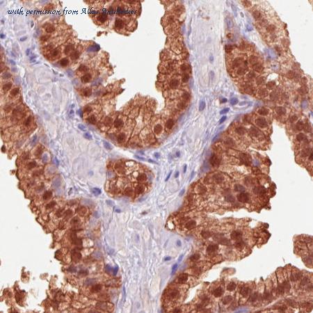 Atlas Antibodies AMAb90578 image 3