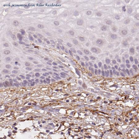 Atlas Antibodies AMAb90584 image 3