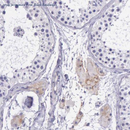Atlas Antibodies AMAb90621 image 1