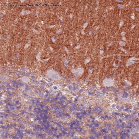 Atlas Antibodies AMAb90621 image 2