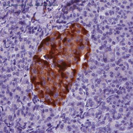 Atlas Antibodies AMAb90621 image 3