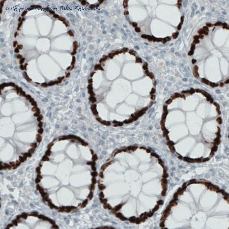 Atlas Antibodies AMAb90679 image 1