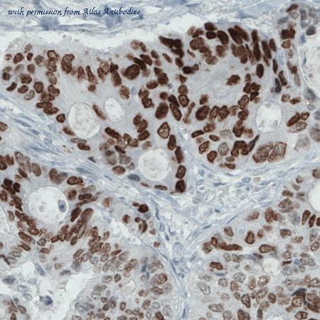 Atlas Antibodies AMAb90679 image 2