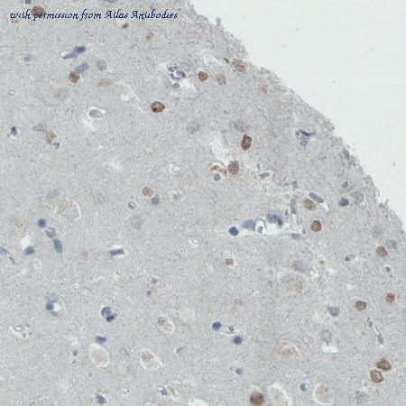 Atlas Antibodies AMAb90679 image 3
