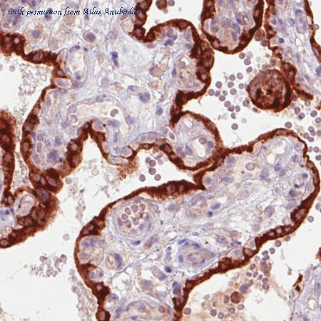 Atlas Antibodies AMAb90687 image 1