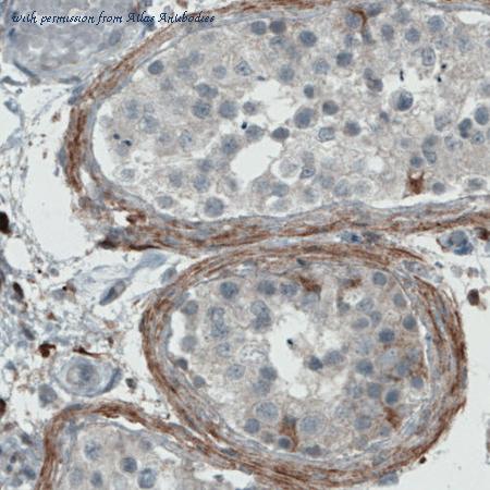 Atlas Antibodies AMAb90696 image 1