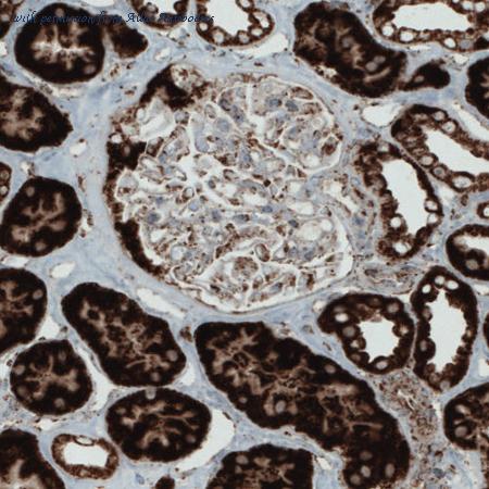 Atlas Antibodies AMAb90708 image 1
