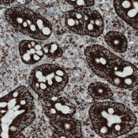 Atlas Antibodies AMAb90708 image 3