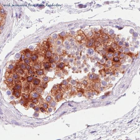 Atlas Antibodies AMAb90710 image 2
