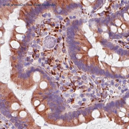 Atlas Antibodies AMAb90710 image 3
