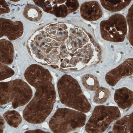 Atlas Antibodies AMAb90725 image 1