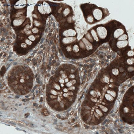 Atlas Antibodies AMAb90725 image 2