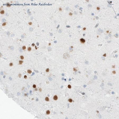 Atlas Antibodies AMAb90728 image 1