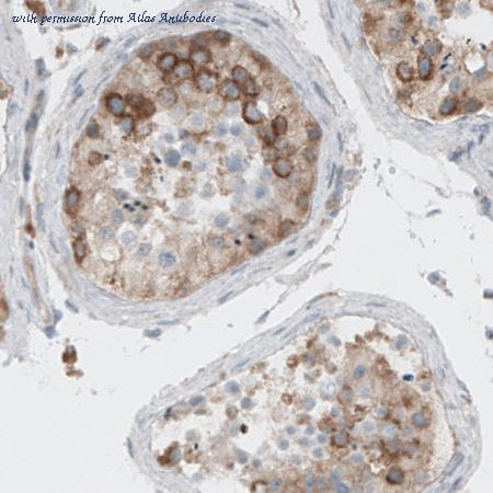 Atlas Antibodies AMAb90737 image 2