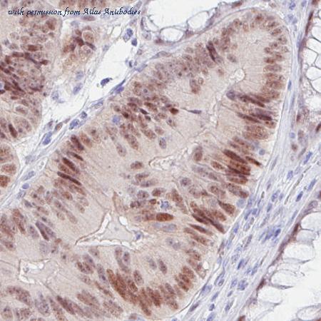 Atlas Antibodies AMAb90789 image 3
