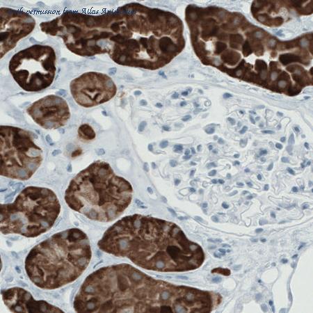 Atlas Antibodies AMAb90791 image 1