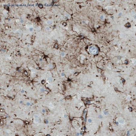 Atlas Antibodies AMAb90791 image 2