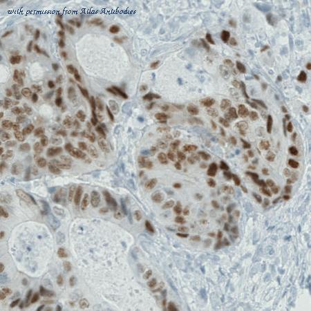 Atlas Antibodies AMAb90795 image 3