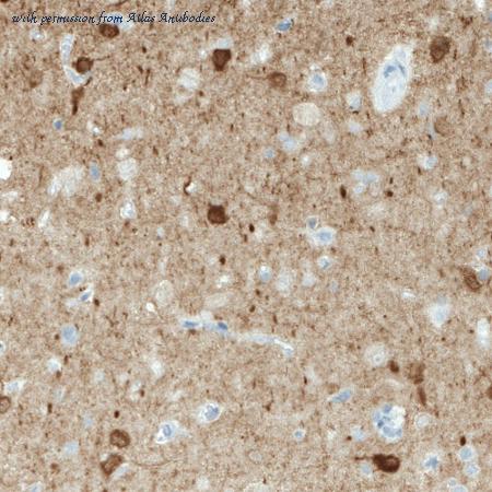 Atlas Antibodies AMAb90801 image 1