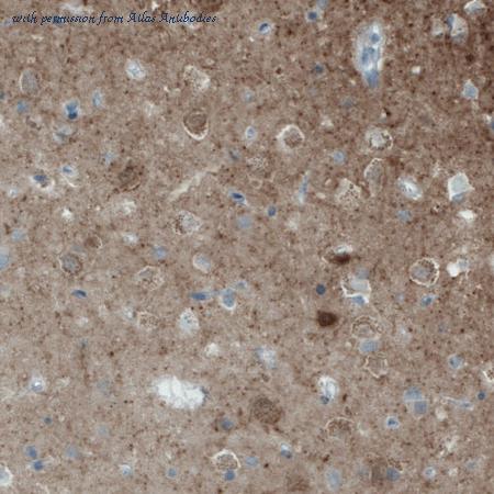 Atlas Antibodies AMAb90808 image 1