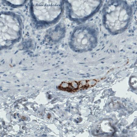 Atlas Antibodies AMAb90808 image 2