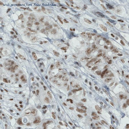 Atlas Antibodies AMAb90841 image 2