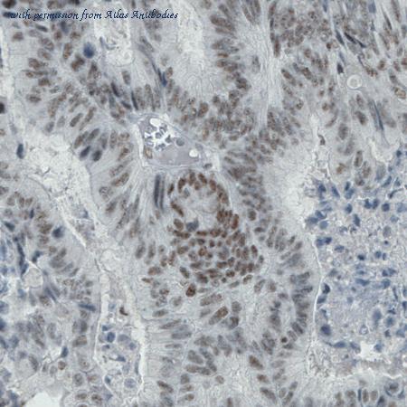 Atlas Antibodies AMAb90841 image 3