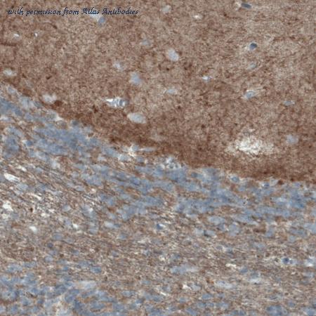 Atlas Antibodies AMAb90846 image 1