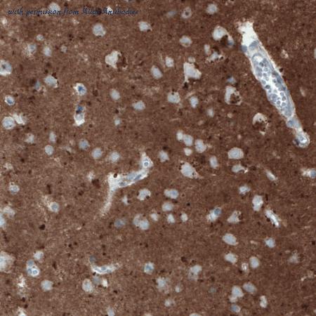 Atlas Antibodies AMAb90846 image 2