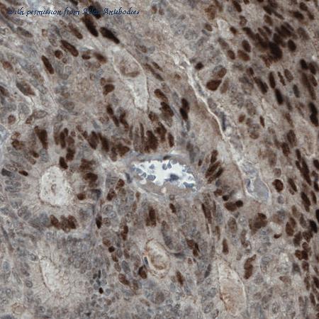 Atlas Antibodies AMAb90851 image 2