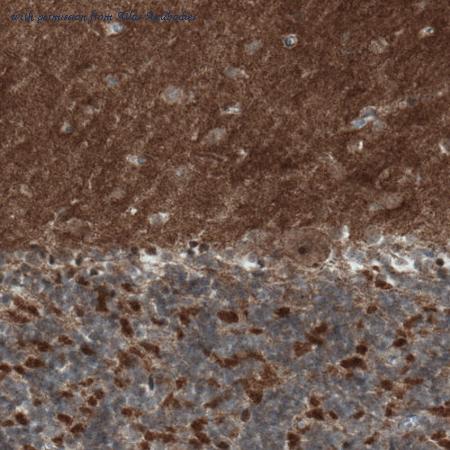 Atlas Antibodies AMAb90852 image 1